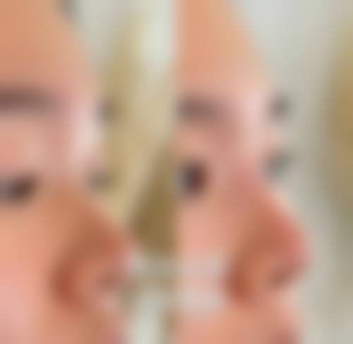 五、岳阳倍特丽医疗美容门诊部价格表