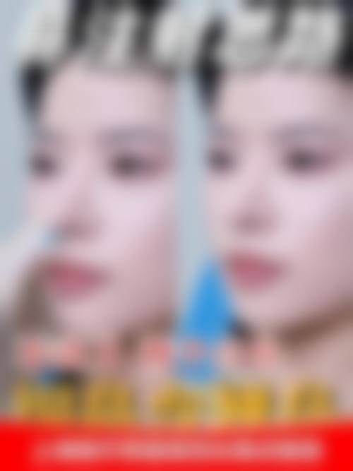 五、韩国金仁键整形美容医院价格表