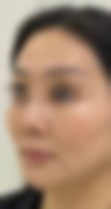 四、成都瑞文柏悦医疗美容特色项目