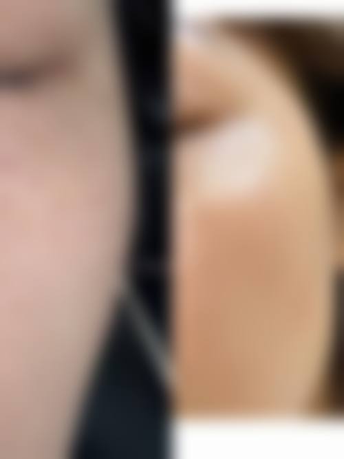 四、成都武侯艾米丽医疗美容机构特色项目