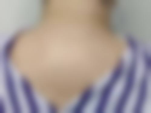 八、宁波鄞州美人颂整形医院真实的患者评价