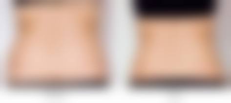 九、武汉安享美整形医院真实的患者评价