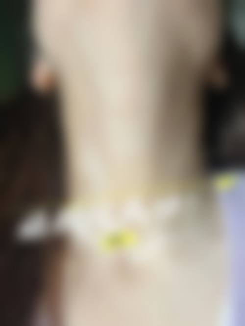 九、包头汇美医疗美容门诊部真实的患者评价