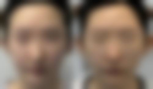 二、深圳红山赫美拉整形医院怎么样?