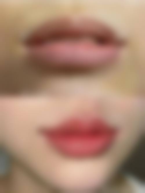 四、南京苏王医疗美容特色项目