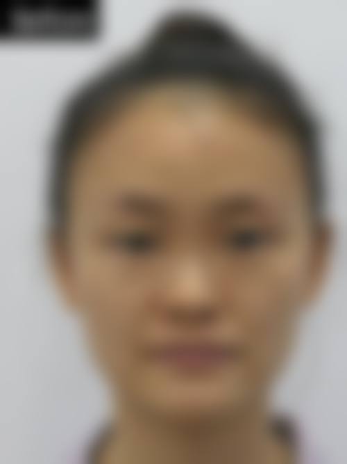 八、成都瑞文柏悦医疗美容真实的患者评价