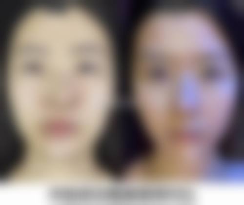 六、武汉安享美整形医院价格表