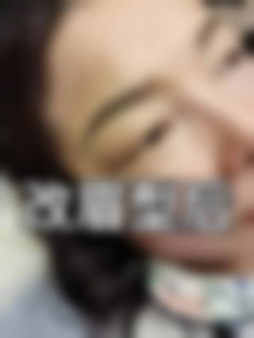 六、哈尔滨美辰医院整形科价格表