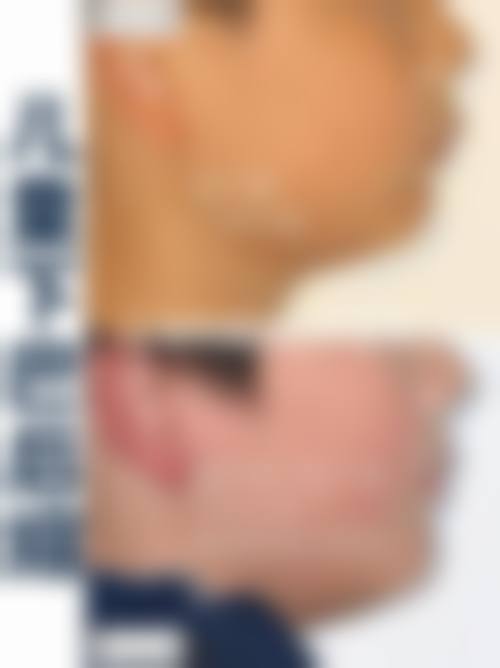 四、武汉伊莱丝医疗美容诊所特色项目