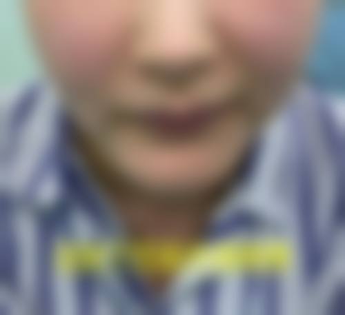 八、韩国金仁键整形美容医院真实的患者评价