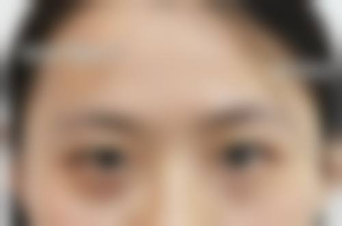 二、杭州迪贝雅医疗美容诊所怎么样?