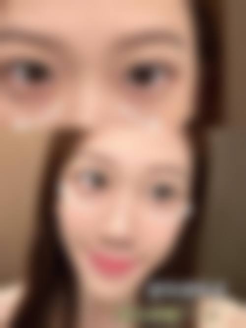 四、杭州迪贝雅医疗美容诊所特色项目