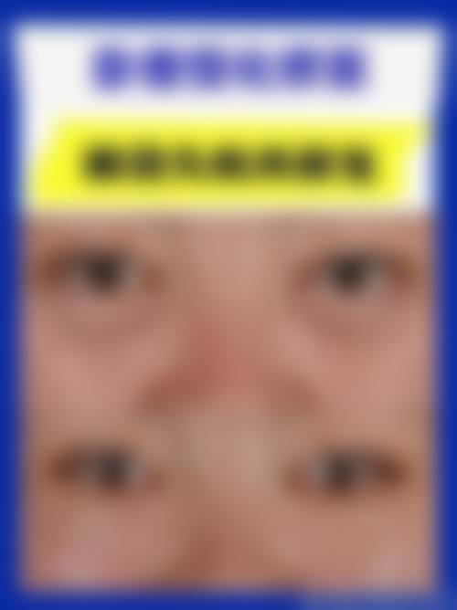 四、包头汇美医疗美容门诊部特色项目