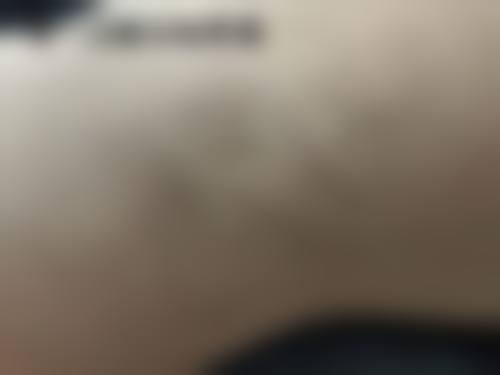 二、太原大麦微针植发(原科发源植发)怎么样?