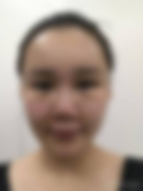 八、武汉美加壹汉(博漉)医疗美容门诊部真实的患者评价