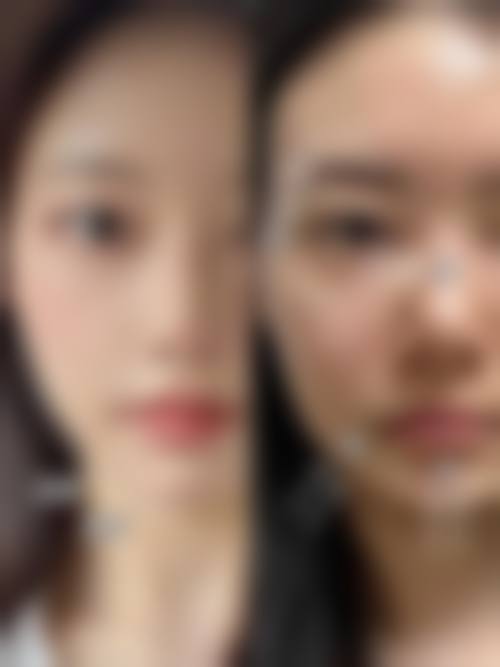 三、厦门爱思特张敏整形诊疗项目有哪些?