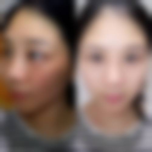 九、上海天美医疗美容门诊部真实的患者评价