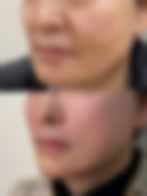 八、襄阳青橙医美医学美容门诊部预约方式