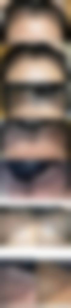 六、太原大麦微针植发(原科发源植发)价格表