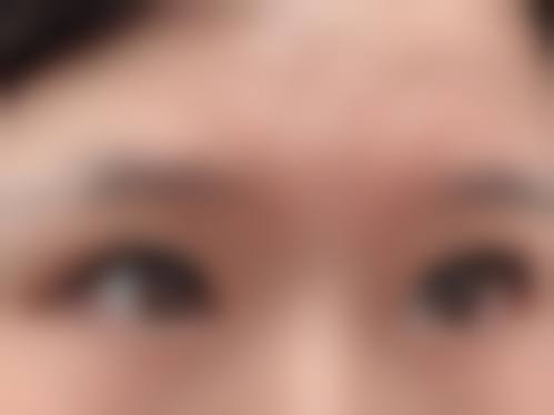 四、贵州铜仁绽新白翎整形（原白领）特色项目