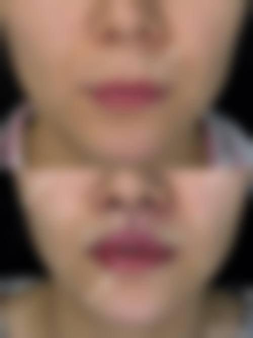 八、上海天美医疗美容门诊部预约方式