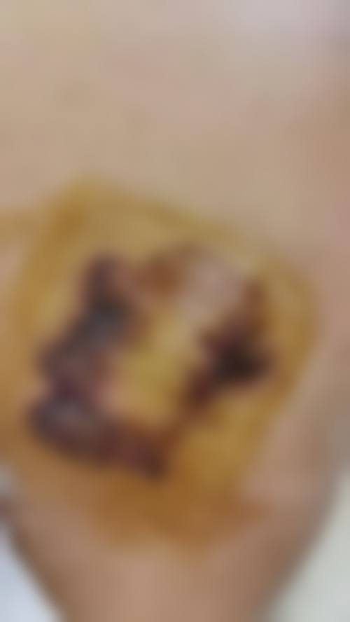 三、贵州铜仁绽新白翎整形（原白领）诊疗项目有哪些？