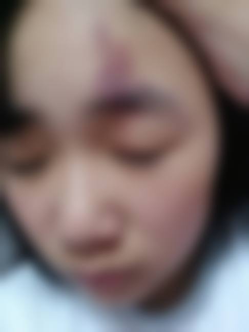 八、重庆仟体秀美容中 心真实的患者评价