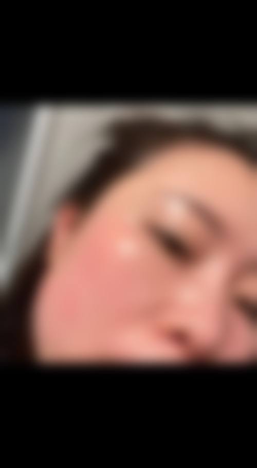 五、韩国 NU 整形外科医院价格表