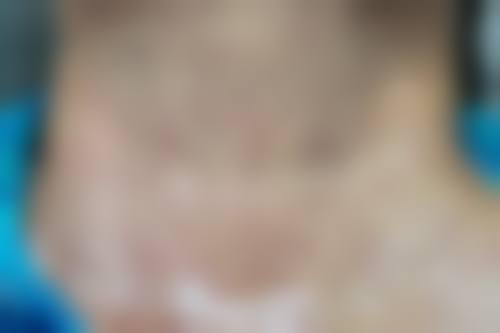 六、贵州铜仁绽新白翎整形（原白领）价格表