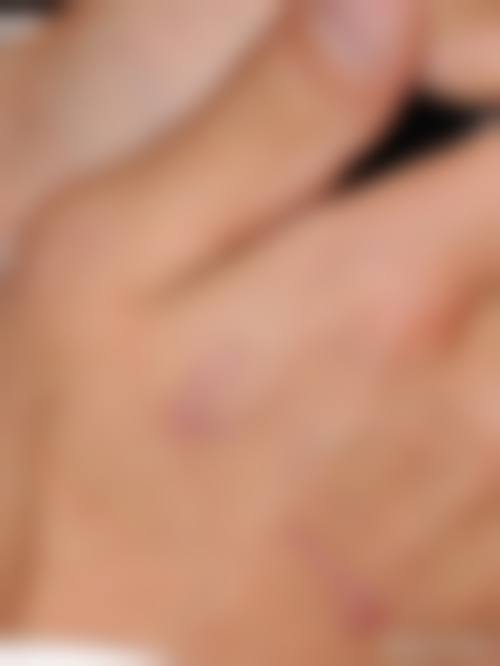 八、厦门爱思特张敏整形预约方式