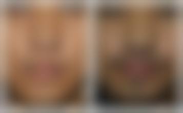 四、阜阳韩美美莱医疗美容门诊部特色项目