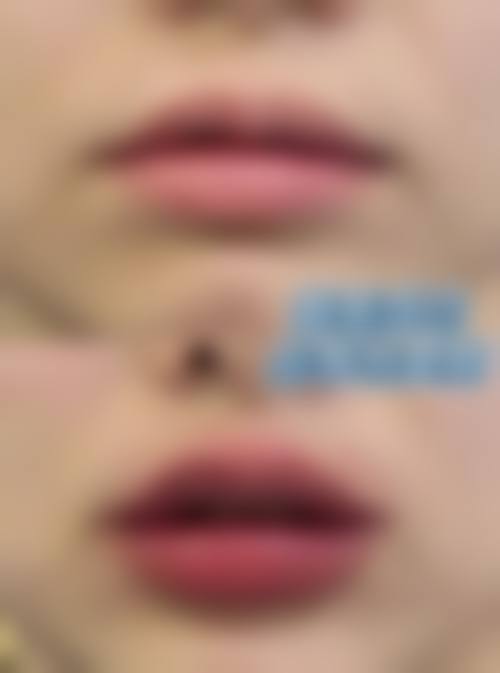 六、襄阳青橙医美医学美容门诊部价格表