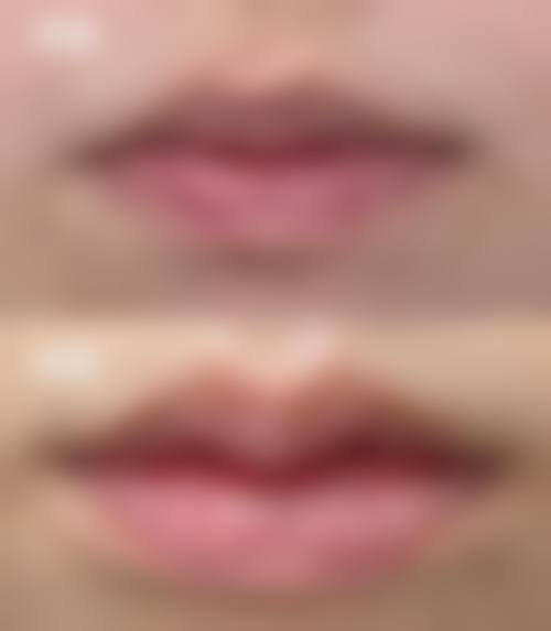 六、南昌爱容颜医疗美容门诊部价格表