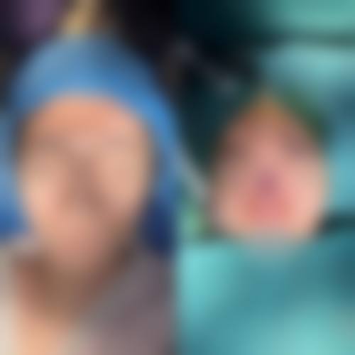 四、韩国 NU 整形外科医院特色项目