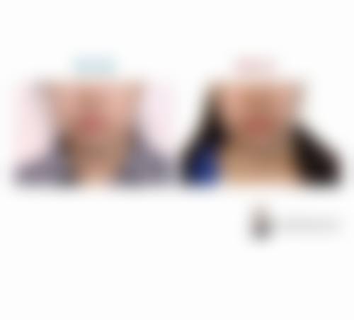 三、佛山东皇医疗美容诊疗项目有哪些?