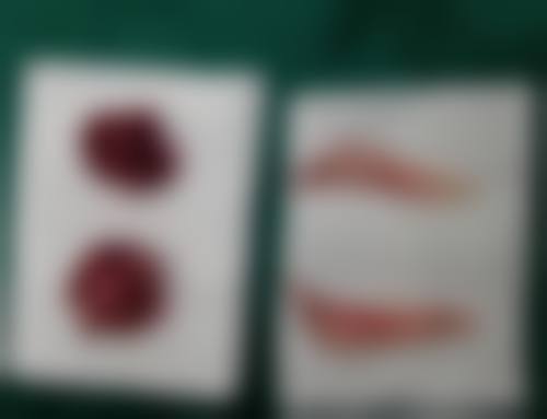 六、石嘴山市石炭井医院医疗美容科地址及交通