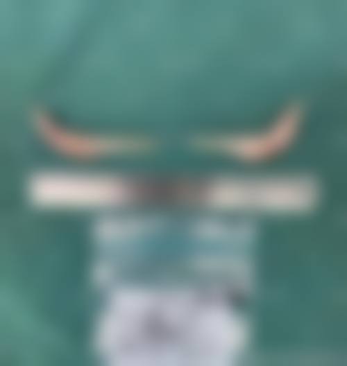 八、石嘴山市石炭井医院医疗美容科真实的患者评价