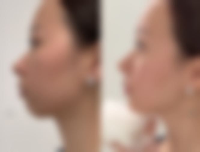 三、韩国 NU 整形外科医院诊疗项目有哪些？