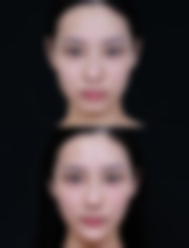 七、濮阳缔莱美整形美容预约方式