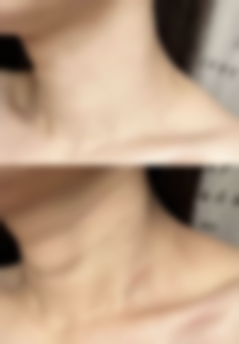 五、武汉美加壹汉(博漉)医疗美容门诊部价格表