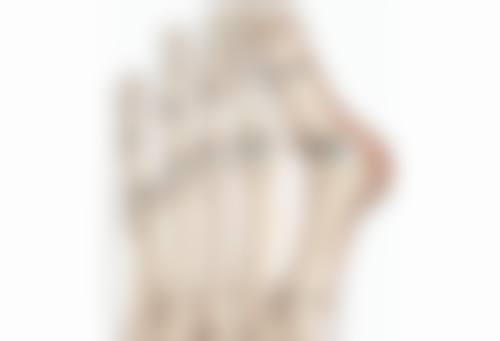 五、割双眼皮6个月后若需修复的准备