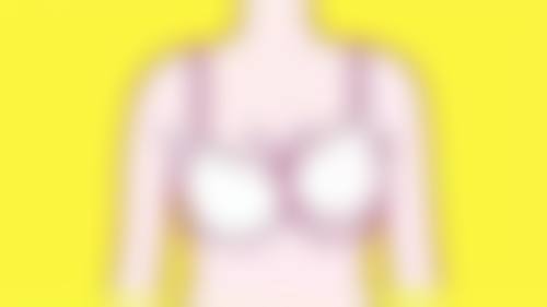 三、割双眼皮后如何判断是否需要修复