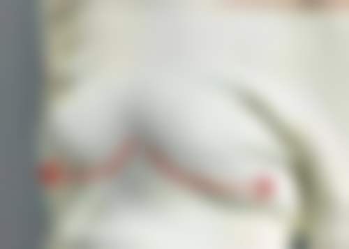 二、疤痕增生修复的时机