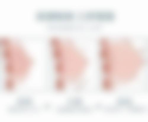 疤痕体可以点斑吗？了解风险、适用情况及替代方案让点斑更安心 