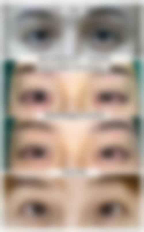 四、长春伶秀致美整形医院特色项目