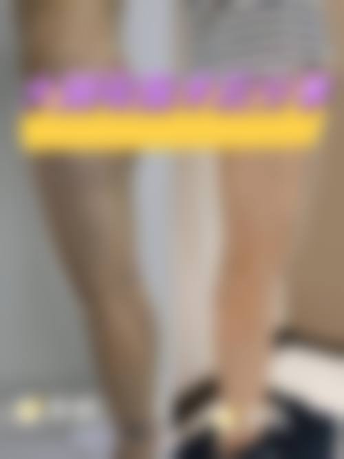 九、韩国4ever整容外科真实的患者评价