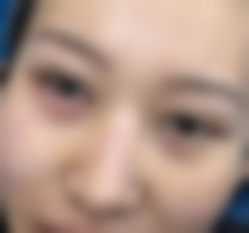 八、武汉美成医院真实的患者评价