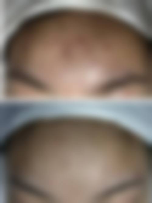 四、广州鸿业医学美容门诊部特色项目