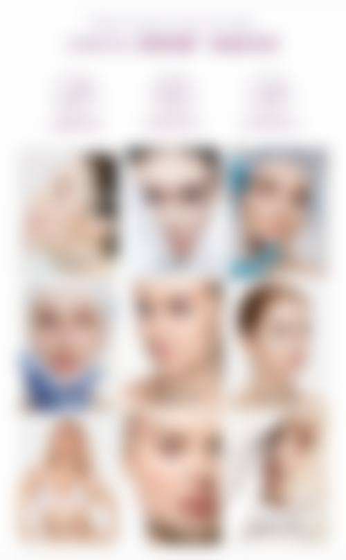 四、四川资阳精美源医疗美容特色项目