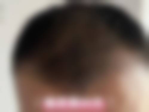 二、济南真程植发医院怎么样？